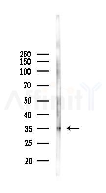 HOXB2 Antibody - Western blot analysis of lysates from 293 cells(heat-shock, 45min treatment), using HOXB2 Antibody at 1/1000 dilution.