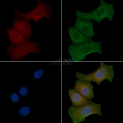 TRP2/DCT Antibody - DF4135 staining Hela cells(45min of heat-shock) by IF/ICC.