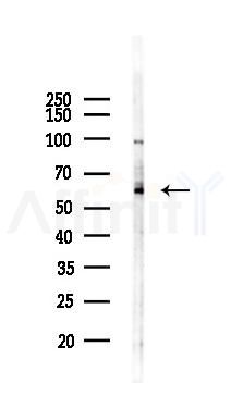 LILRA2 Antibody - Western blot analysis of lysates from HUVEC cells(starvation,24h treatment), using LILRA2 Antibody at 1/1000 dilution.