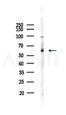 LILRA2 Antibody - Western blot analysis of lysates from HUVEC cells(starvation,24h treatment), using LILRA2 Antibody at 1/1000 dilution.