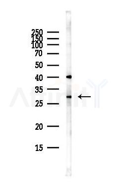 MED8 Antibody - Western blot analysis of lysates from HepG2 cells(heat-shock,45min treatment), using MED8 Antibody at 1/1000 dilution.