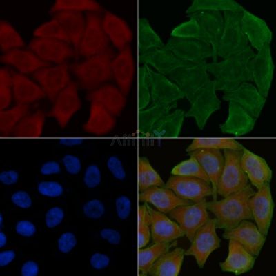 MBTPS1 Antibody - DF4159 staining Hela cells(30min of UV treatment) by IF/ICC.