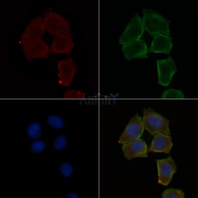 MAP9 Antibody - DF4163 staining Hela cells(30min of UV treatment) by IF/ICC.