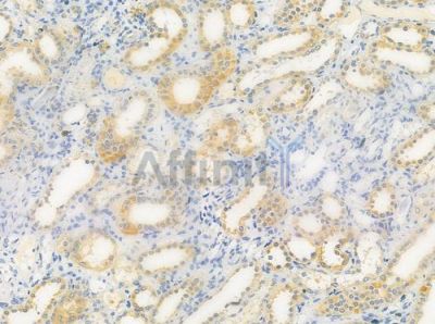 MRPL39 Antibody - DF4175 at 1/100 staining human normal kidney tissue by IHC-P.