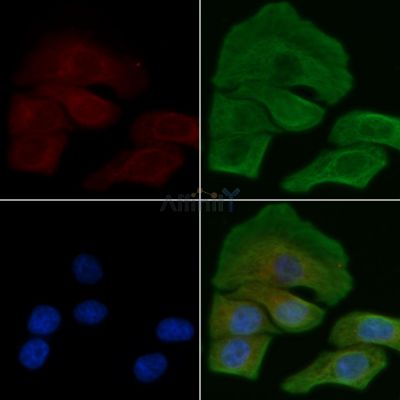 SLC16A2 Antibody - DF4183 staining Hela cells by IF/ICC.