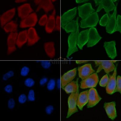 MEGF8 Antibody - DF4187 staining Hela cells(30min of UV treatment) by IF/ICC.