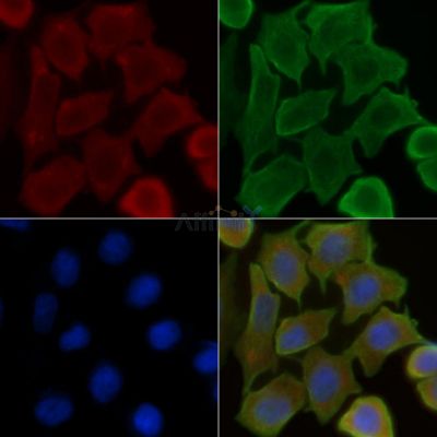Myoglobin Antibody - DF4194 staining Hela cells(30min of UV treatment) by IF/ICC.