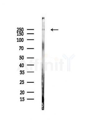 MYO9B Antibody - Western blot analysis of lysates from Rat brain, using MYO9B Antibody at 1/1000 dilution.