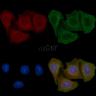 CYB5R1 Antibody - DF4211 staining Hela cells(45min of heat-shock) by IF/ICC.
