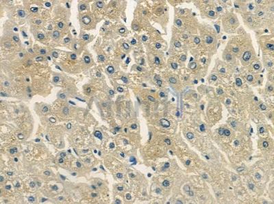 NDUFS1 Antibody - DF4213 at 1/100 staining human normal liver tissue by IHC-P.