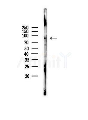 NOX5 Antibody - Western blot analysis of lysates from Mouse liver, using NOX5 Antibody at 1/1000 dilution.