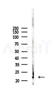 NMU Antibody - Western blot analysis of lysates from RAW264.