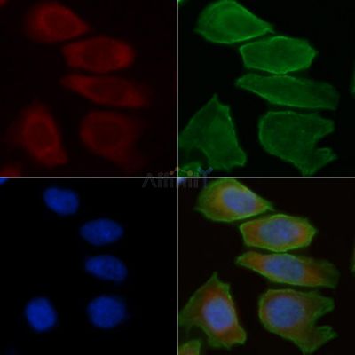 CHRNA10 Antibody - DF4239 staining Hela cells(30min of UV treatment) by IF/ICC.