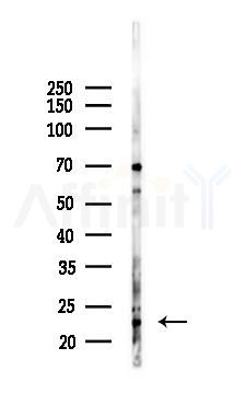 NSG1 Antibody - Western blot analysis of lysates from HepG2 cells(heat-shock,45min treatment), using NSG1 Antibody at 1/1000 dilution.