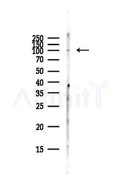 NUP107 Antibody - Western blot analysis of lysates from Hela cells(starvation,24h treatment), using NUP107 Antibody at 1/1000 dilution.