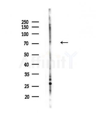 NOL10 Antibody - Western blot analysis of lysates from Mouse lung, using NOL10 Antibody at 1/1000 dilution.