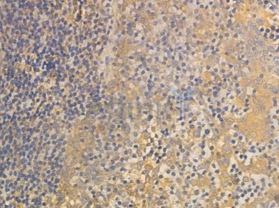 OGFR Antibody - DF4267 at 1/100 staining human normal tonsil tissue by IHC-P.