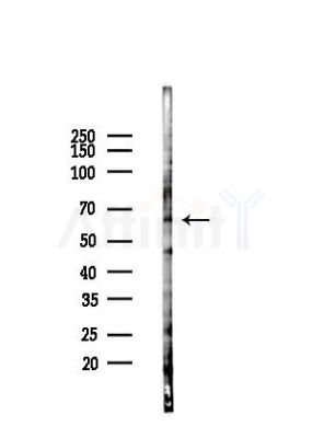 SLC22A3 Antibody - Western blot analysis of lysates from LoVo cells(heat-shock,45min treatment), using SLC22A3 Antibody at 1/1000 dilution.