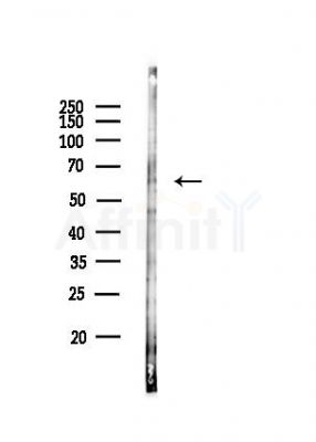 SLC22A3 Antibody - Western blot analysis of lysates from HUVEC cells(heat-shock,42min treatment), using SLC22A3 Antibody at 1/1000 dilution.