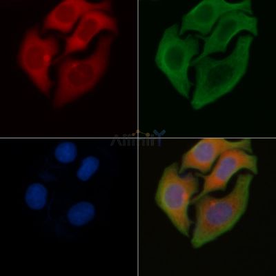 ZDHHC15 Antibody - DF4275 staining Hela cells by IF/ICC.