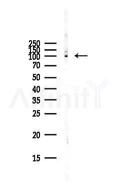 PKP2 Antibody - Western blot analysis of lysates from Hela cells(starvation,24h treatment), using PKP2 Antibody at 1/1000 dilution.