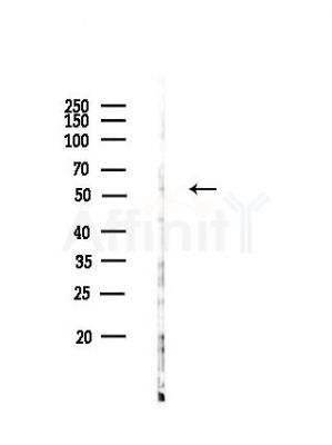 PVRL4 Antibody - Western blot analysis of lysates from HUVEC cells(heat-shock,42min treatment), using PVRL4 Antibody at 1/1000 dilution.