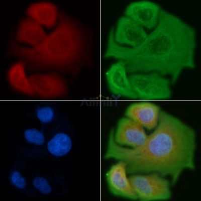 KCNK17 Antibody - DF4308 staining Hela cells by IF/ICC.