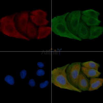KCNK4 Antibody - DF4309 staining Hela cells by IF/ICC.