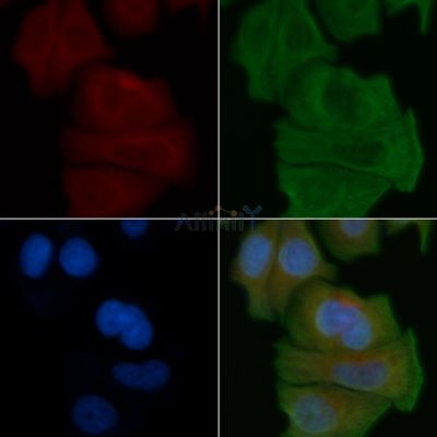 KCNC1 Antibody - DF4314 staining Hela cells by IF/ICC.