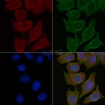 KCNG2 Antibody - DF4317 staining Hela cells(30min of UV treatment) by IF/ICC.