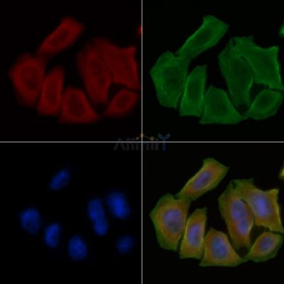 KCNG3 Antibody - DF4318 staining Hela cells(30min of UV treatment) by IF/ICC.