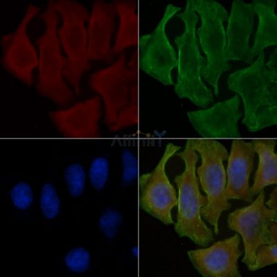 KCNH3 Antibody - DF4320 staining Hela cells(30min of UV treatment) by IF/ICC.