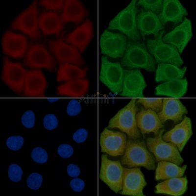 KCNQ4 Antibody - DF4321 staining Hela cells(45min of heat-shock) by IF/ICC.
