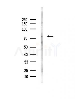 PRPF39 Antibody - Western blot analysis of lysates from HepG2 cells(heat-shock,45min treatment), using PRPF39 Antibody at 1/1000 dilution.