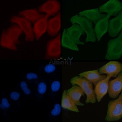 A26B1 Antibody - DF4337 staining Hela cells by IF/ICC.