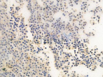 PPP1R16A Antibody - DF4344 at 1/100 staining human pituitary adenoma by IHC-P.