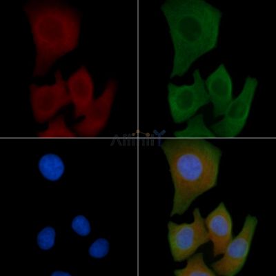 PPM1K Antibody - DF4348 staining Hela cells by IF/ICC.
