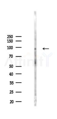 SSH3 Antibody - Western blot analysis of lysates from HepG2 cells(heat-shock,45min treatment), using SSH3 Antibody at 1/1000 dilution.
