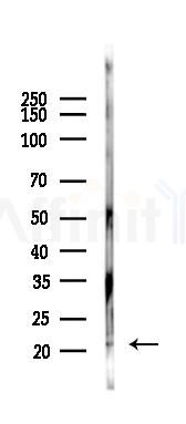 PMS2/PMS2CL Antibody - Western blot analysis of lysates from Rat lung, using PMS2/PMS2CL Antibody at 1/1000 dilution.