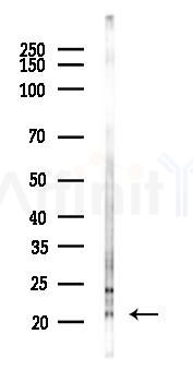 PMS2/PMS2CL Antibody - Western blot analysis of lysates from Mouse lung, using PMS2/PMS2CL Antibody at 1/1000 dilution.