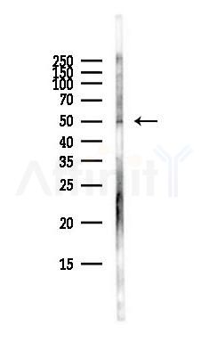 PDK2 Antibody - Western blot analysis of lysates from Hela cells(starvation,24h treatment), using PDK2 Antibody at 1/1000 dilution.