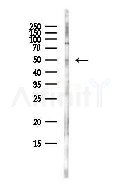 PDK2 Antibody - Western blot analysis of lysates from HepG2 cells(heat-shock,45min treatment), using PDK2 Antibody at 1/1000 dilution.