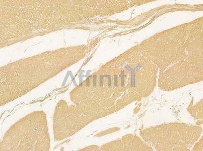 CHML Antibody - DF4369 at 1/100 staining human normal gastric tissue by IHC-P.