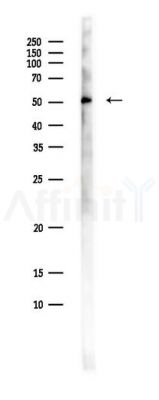RAB11FIP2 Antibody - Western blot analysis of lysates from Hela cells(starvation,24h treatment), using RAB11FIP2 Antibody at 1/1000 dilution.