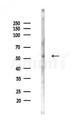 RAB11FIP2 Antibody - Western blot analysis of lysates from LoVo cells(heat-shock,45min treatment), using RAB11FIP2 Antibody at 1/1000 dilution.