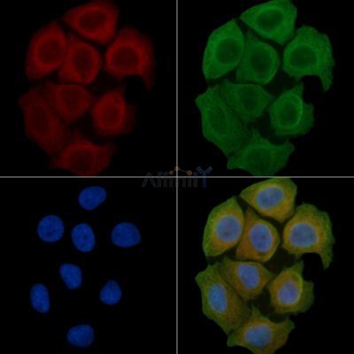 RAB3GAP2 Antibody - DF4372 staining Hela cells(45min of heat-shock) by IF/ICC.