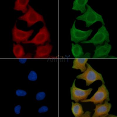 ZFYVE20 Antibody - DF4373 staining Hela cells(45min of heat-shock) by IF/ICC.