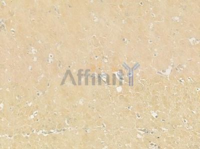 RSAD1 Antibody - DF4375 at 1/100 staining human normal gastric tissue by IHC-P.