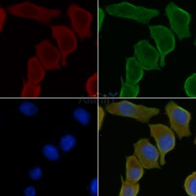 RSAD1 Antibody - DF4375 staining Hela cells(30min of UV treatment) by IF/ICC.