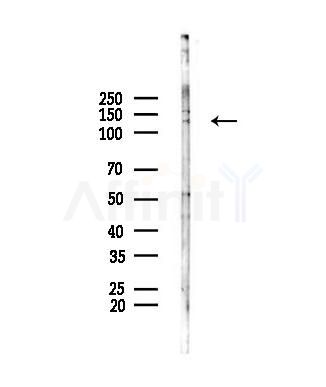 RANBP17 Antibody - Western blot analysis of lysates from A375 cells(heat-shock,45min treatment), using RANBP17 Antibody at 1/1000 dilution.